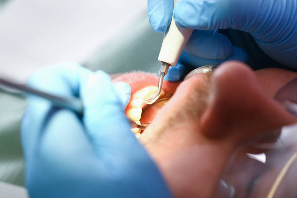 Best Emergency Dental Care for Broken or Chipped Teeth in Kalaeloa, HI